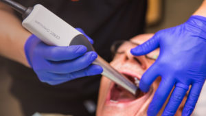 dr banks using cerec scan Inwood WV